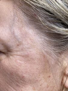 IMG 7267 Groot 225x300 - Teaology skincare routine: ANTI-AGING 🚫👵🏼